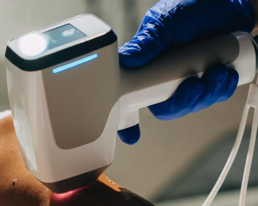 BIOSCHA Beauty Lab'da bacak bölgesine lazer epilasyon uygulaması